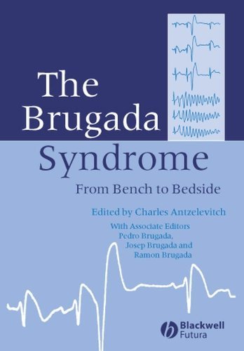 The Brugada Syndrome: From Bench To Bedside: An Overview
